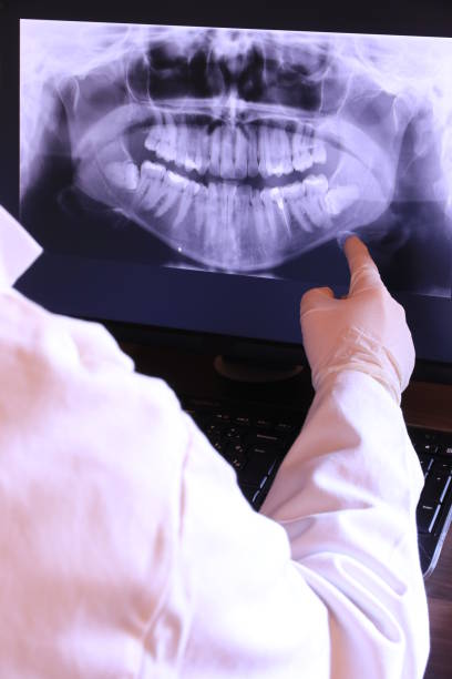 Best Emergency Wisdom Teeth Removal in Landisville, PA